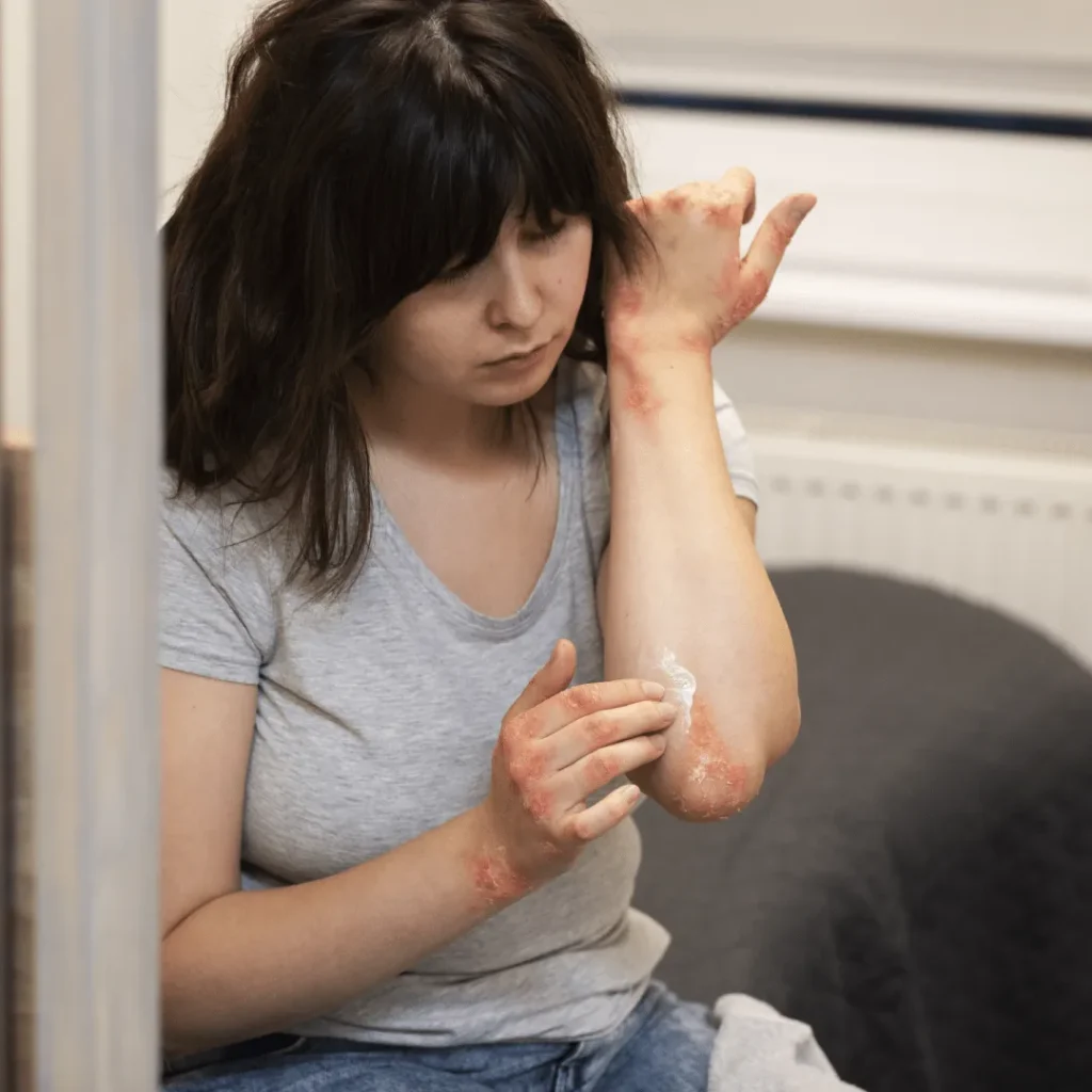 fungal disease-min