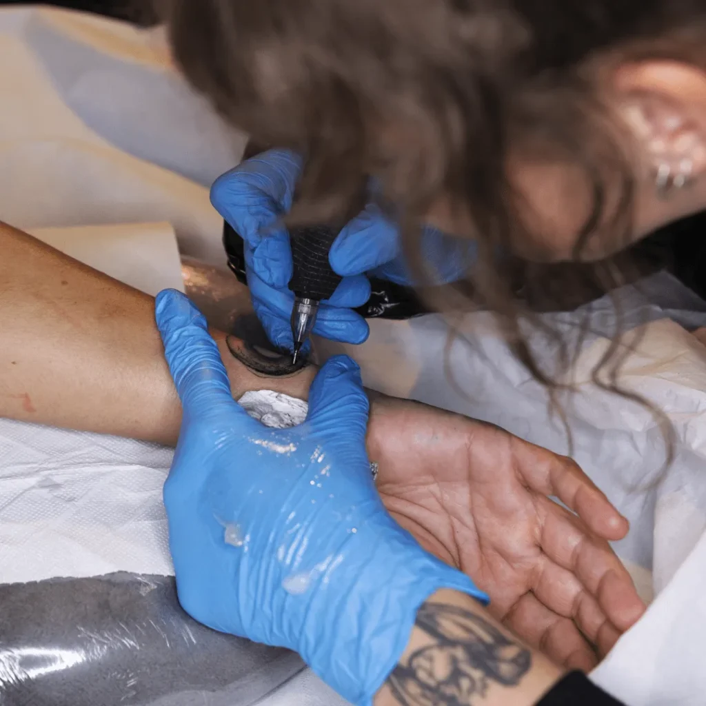tattoo removal-min